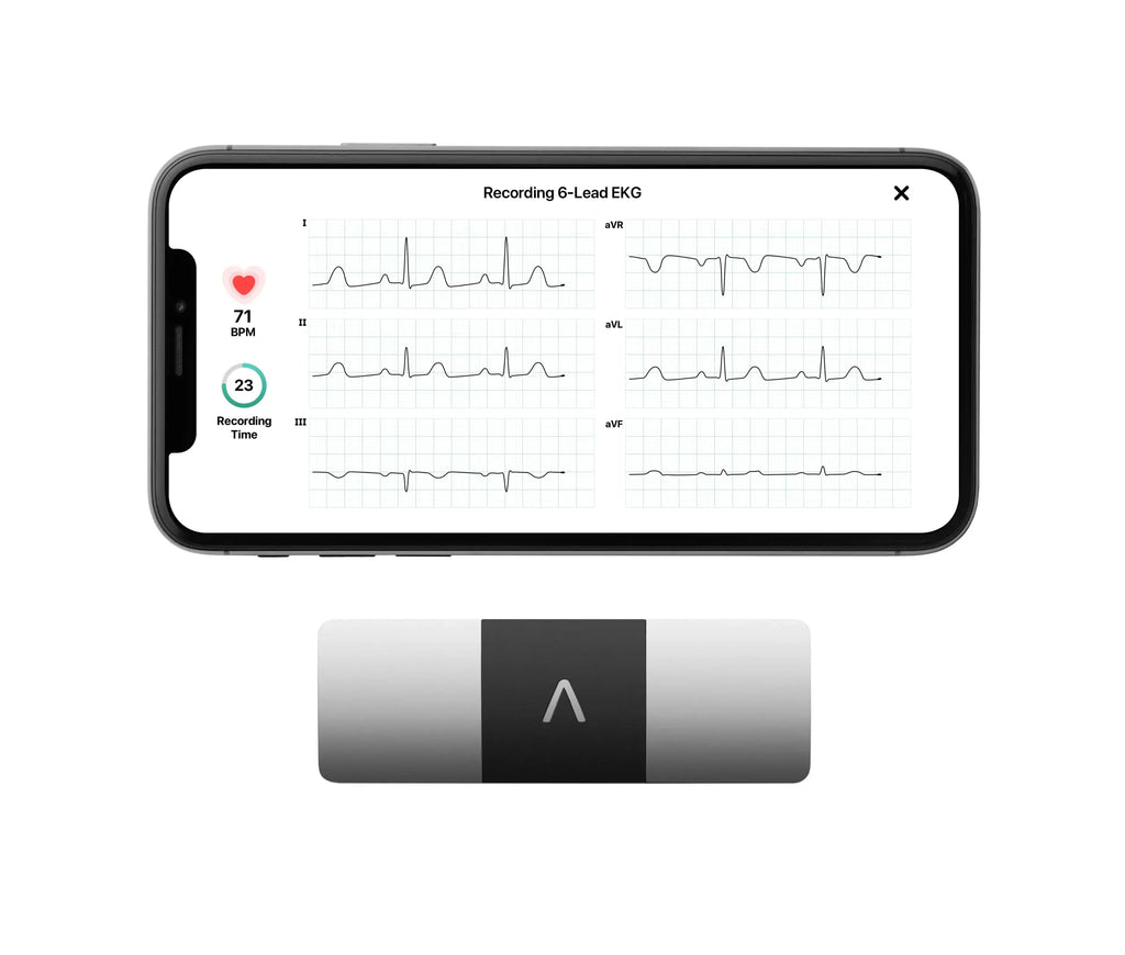 KardiaMobile 6L Personal EKG Monitor with Most Smartphones